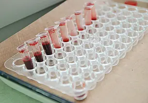 Минздрав: штамп о группе крови может быть внесен в паспорт только по желанию гражданина