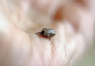 Укусил клещ. Рассказываем, что делать