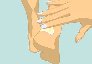 Провизор: пластыри от сухих мозолей эффективны, но есть противопоказания