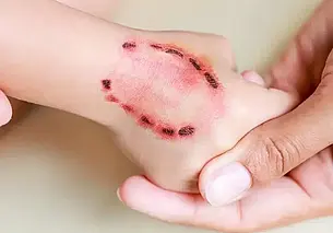 В Могилеве 49-летняя женщина покусала девочку-подростка