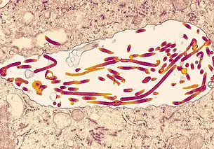 В Африке произошла вспышка смертельного вируса Марбург, смертность от которого достигает 88%