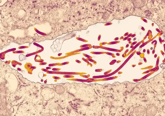 В Африке произошла вспышка смертельного вируса Марбург, смертность от которого достигает 88%