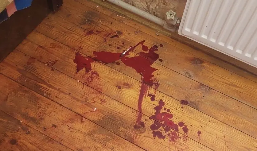 1.06.2023 г. Житель Бобруйска попытался разобрать гранату и подорвался на ней. Фото: СК РБ.