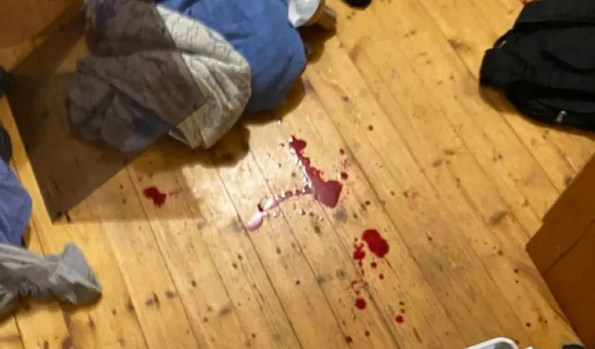 Мать парня получила удары ножом в шею и область груди, бабушка была ранена в шею. Фото: sk.gov.by.