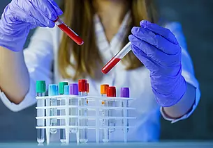 Могилевчанин заразился туляремией от зайца. Разделывал тушку животного без перчаток