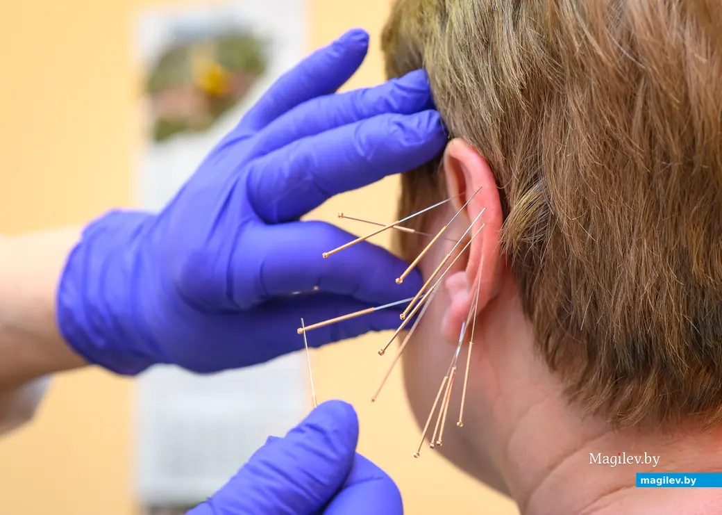 03.04.2024, Бобруйск. Санаторий им. Ленина. Врач Валентина Ивановна Аверкова проводит процедуру аурикулотерапии.