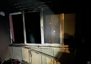 На пожаре в агрогородке Полыковичи Могилевского района пострадал ребенок