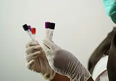Если укусил клещ, куда сдать насекомое на исследование: рассказываем