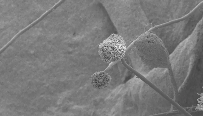 Грибок Aspergillus под микроскопом. Фото: pixabay.com.