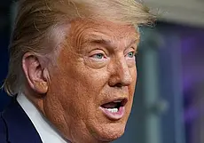 Почему у Трампа такое оранжевое лицо? Объяснил врач