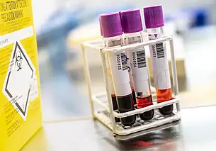 В Китае зафиксирована вспышка метапневмовируса человека