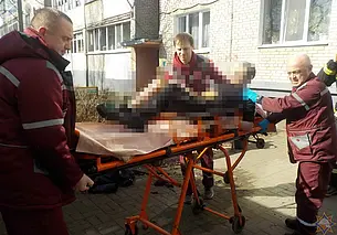 Во дворе многоэтажки в Бобруйске на мужчине загорелась одежда. Он получил ожоги