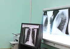 Больной может не подозревать, что он болен, и заражать других. Что нужно знать о туберкулезе