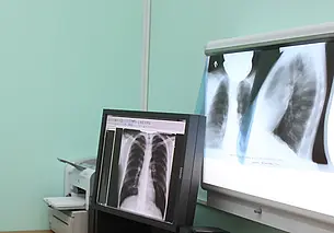 Больной может не подозревать, что он болен, и заражать других. Что нужно знать о туберкулезе